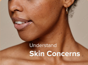Skin Concerns